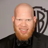 Krondon Net Worth