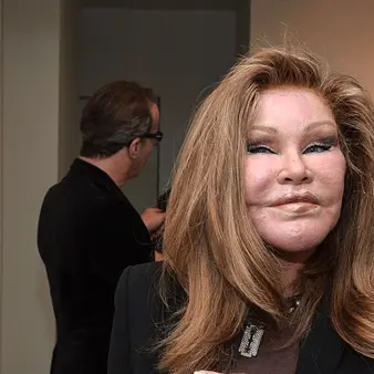 Jocelyn Wildenstein Net Worth