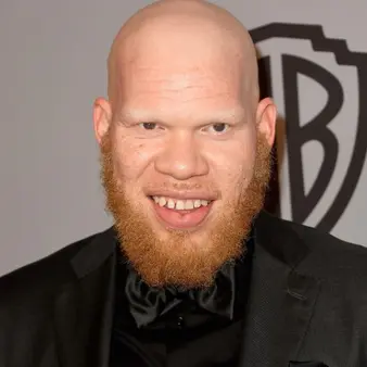 Krondon Net Worth