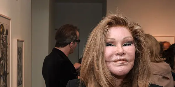 Jocelyn Wildenstein