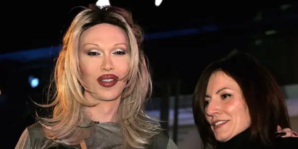 Pete Burns