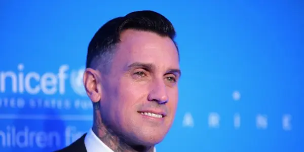 Carey Hart