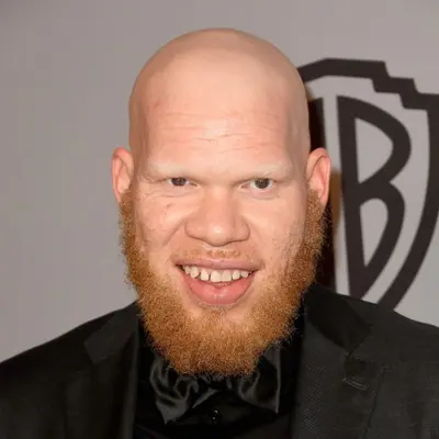 Krondon