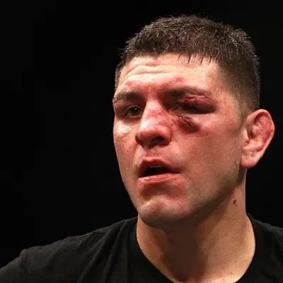 Nick Diaz