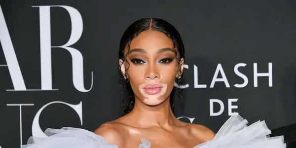 Winnie Harlow