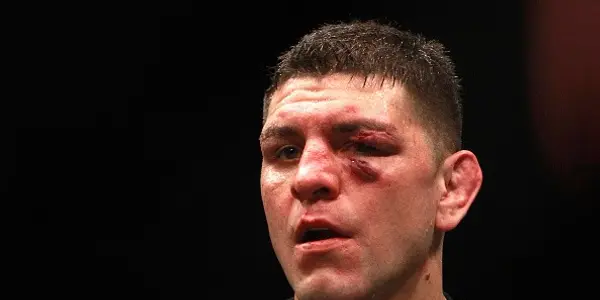 Nick Diaz