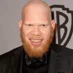 Krondon Net Worth