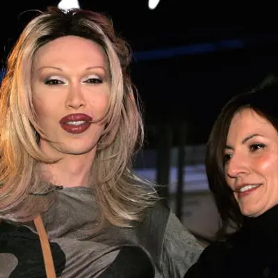Pete Burns