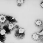 India's Billionaire Poonawalla Family Betting Hundreds Of Millions On Unproven Coronavirus Vaccine