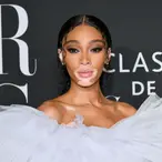 Winnie Harlow Net Worth