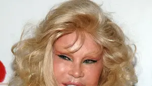 Jocelyn Wildenstein Net Worth | Celebrity Net Worth