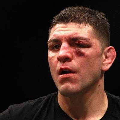 Nick Diaz Net Worth