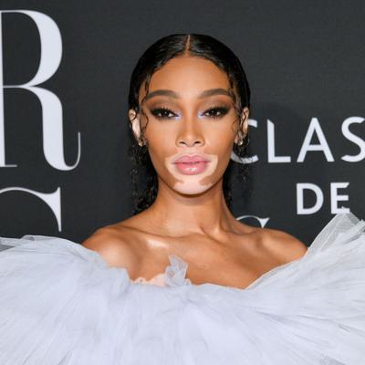 Winnie Harlow Net Worth's picture