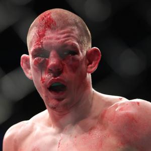 Joe Lauzon Net Worth