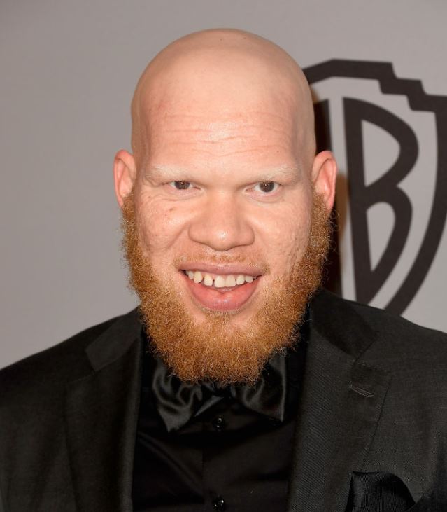 Krondon Net Worth | Celebrity Net Worth