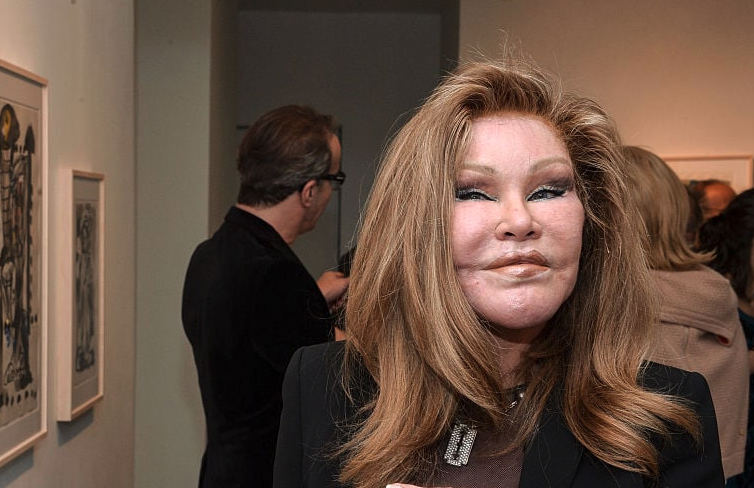 Revealed: Jocelyn Wildenstein  in Net Worth 2026: Career Earnings & Assets
