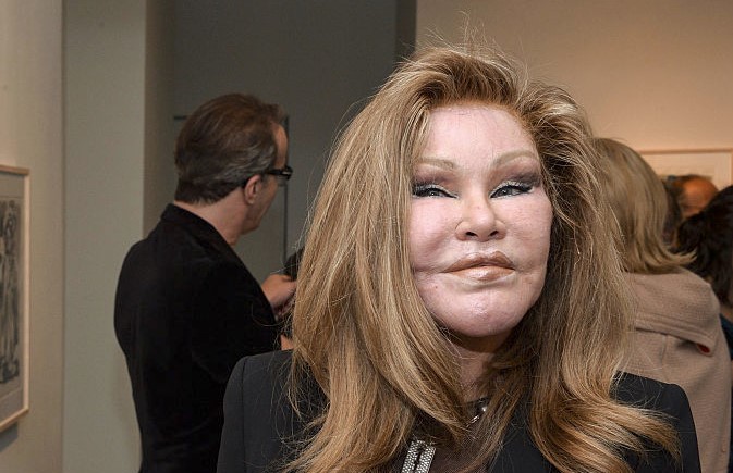 Jocelyn Wildenstein Net Worth | Celebrity Net Worth