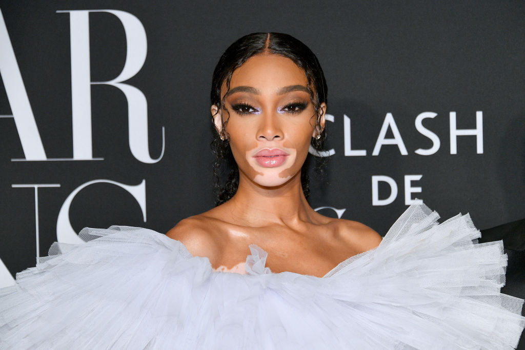 Inside Winnie Harlow's Fortune: Winnie Harlow  in Net Worth 2026: Career Earnings & Assets